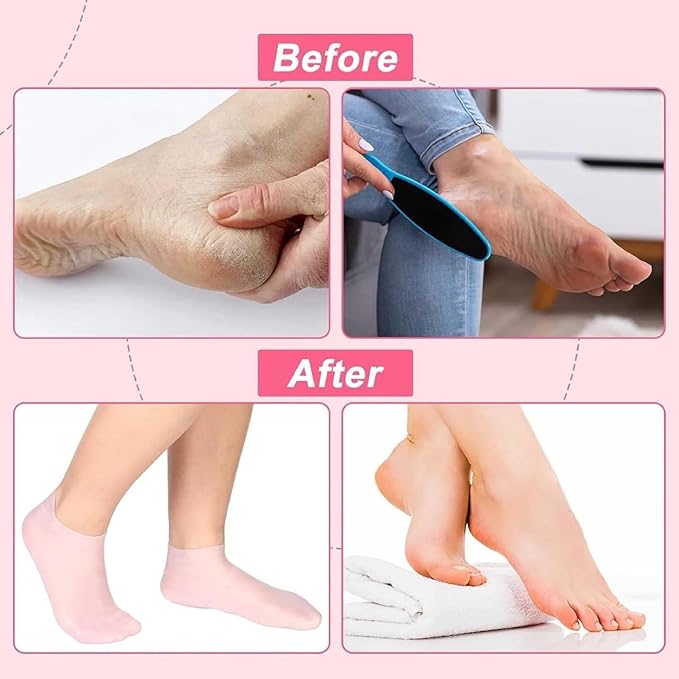 Silicone Yoga Socks for Women